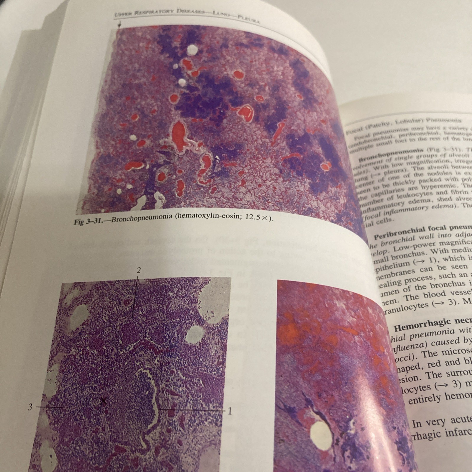 Sandritter’s Color Atlas and Textbook of Histopathology by Carlos Thomas 7th Ed
