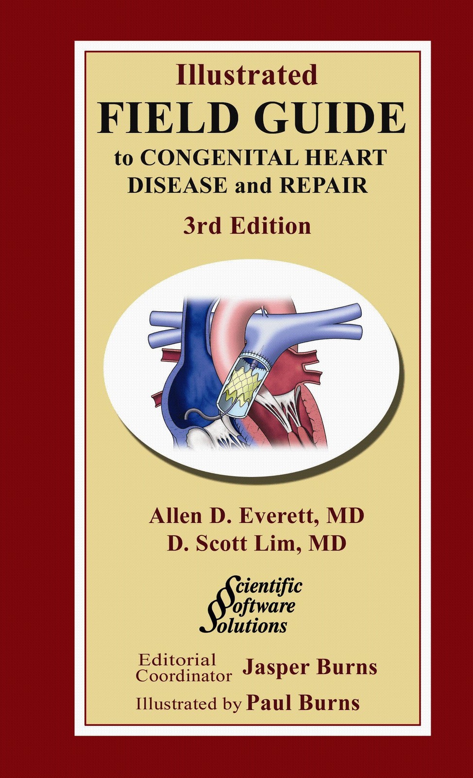 Illustrated Field Guide to Congenital Heart Disease and Repair – Pocket Size…