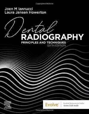 Dental Radiography: Principles and – Paperback, by Iannucci DDS MS – Good o