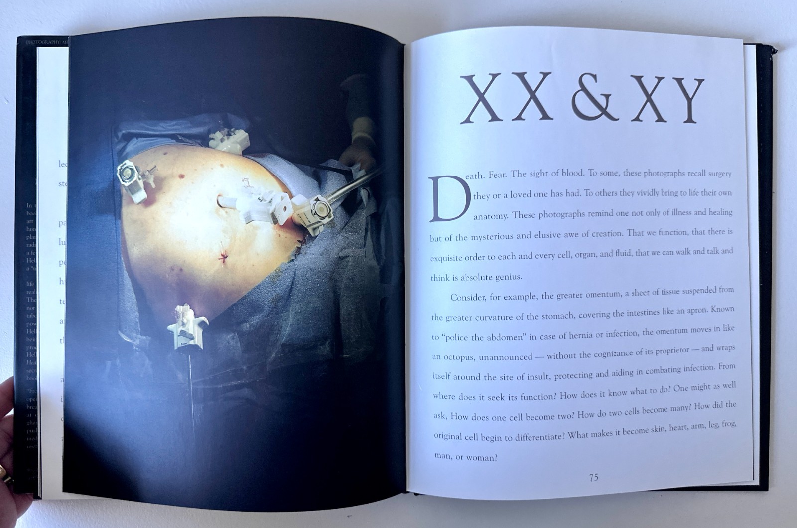 The Sacred Heart 1st Ed 1997 Max Aguilera-Hellweg Medical Photo Surgery Book VTG