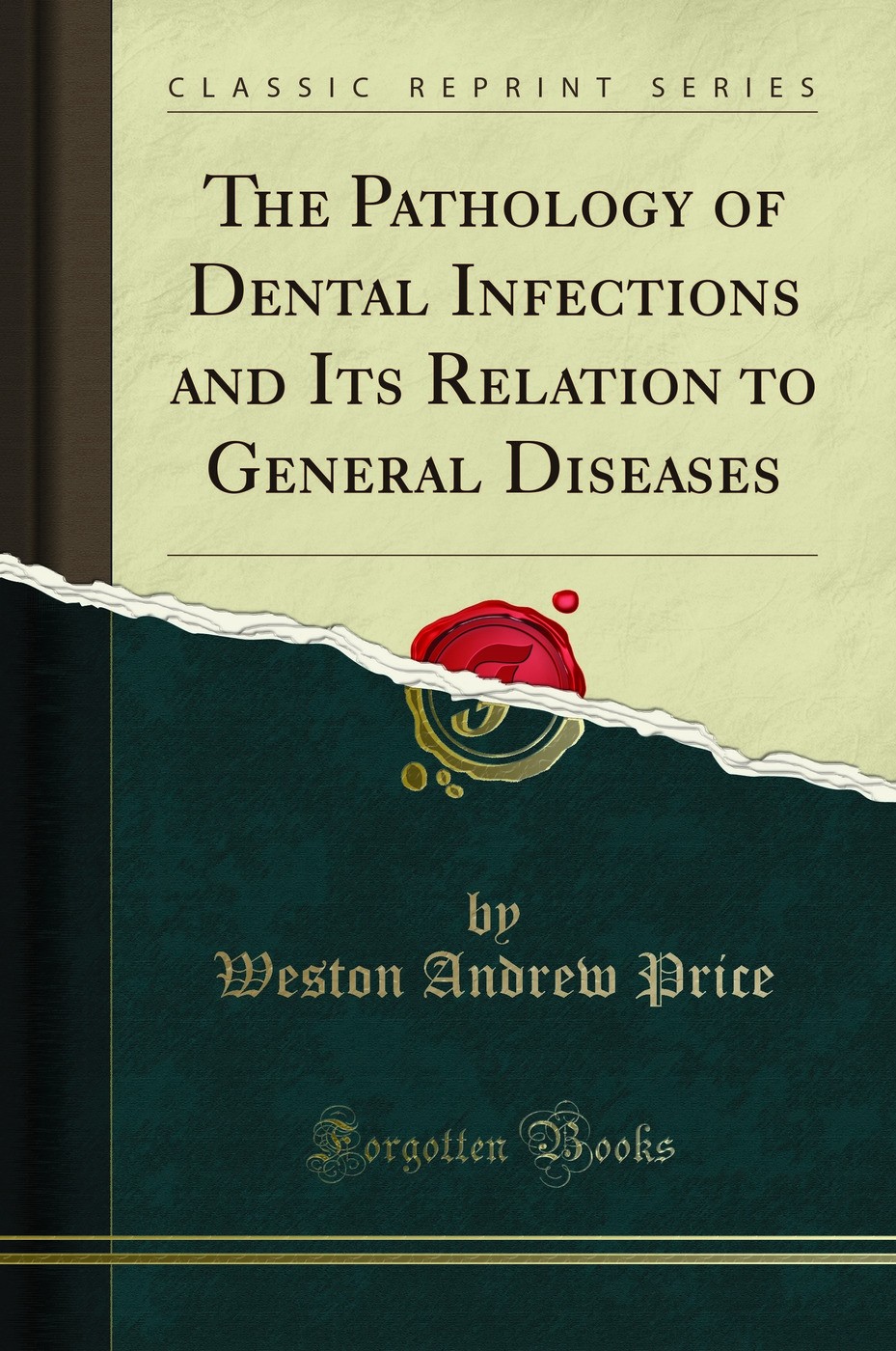 The Pathology of Dental Infections and Its Relation to General Diseases