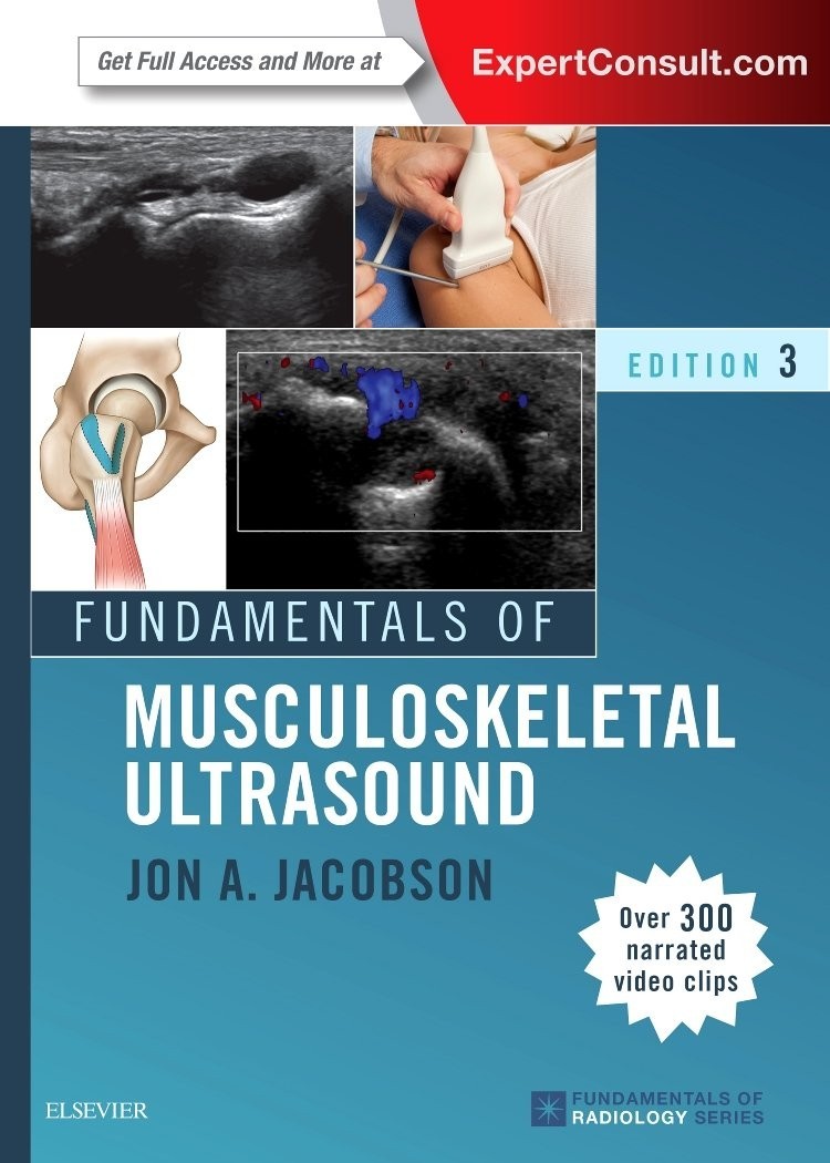 Fundamentals of Musculoskeletal Ultrasound – 3E (Fundamentals of Radiology) PB
