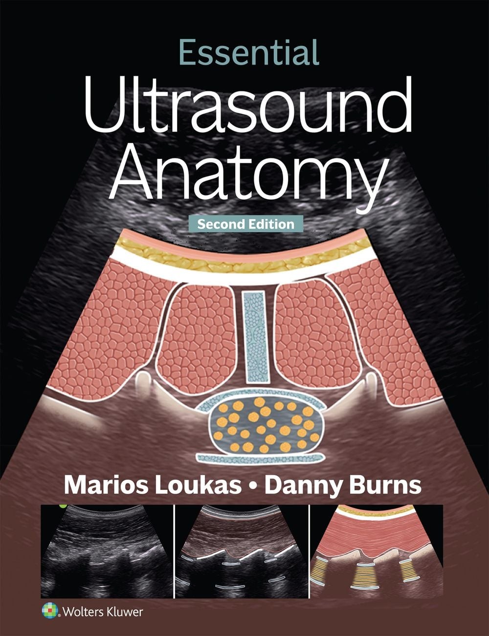 Essential Ultrasound Anatomy by Marios Loukas Paperback Book