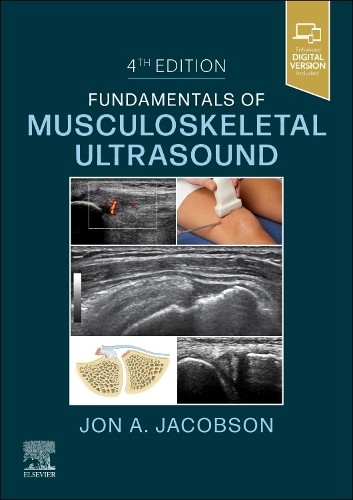 Jon A. Jacobson Fundamentals of Musculoskeletal Ultrasound (Paperback)