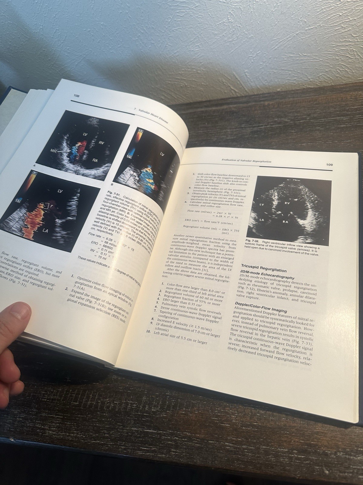 THE ECHO MANUAL: FROM THE MAYO CLINIC Jae K. Oh & James B. Seward – Hardcover