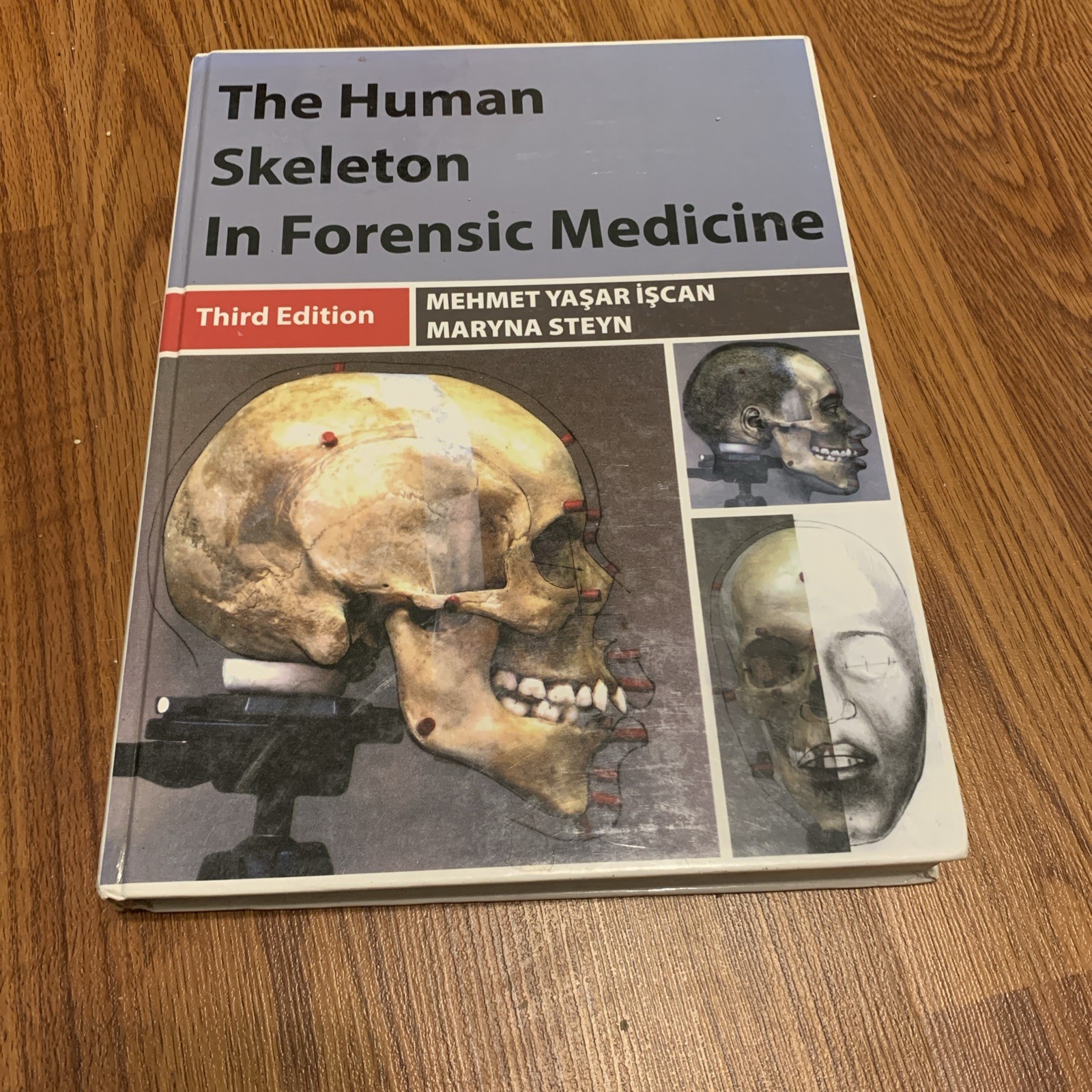 The Human Skeleton In Forensic Medicine