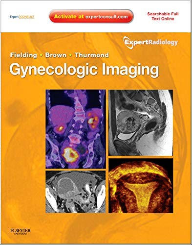 Gynecologic Imaging: Expert Radiology Series (Expert Consult P…