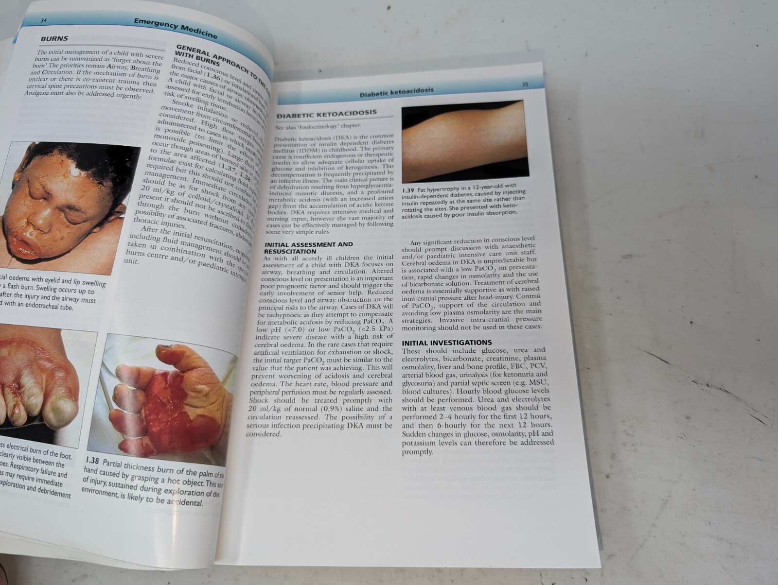 The Great Ormond Street Color Handbook of Paediatrics and Child Health (204)