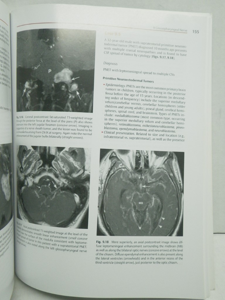 Cranial Nerves: Anatomy, Pathology, Imaging