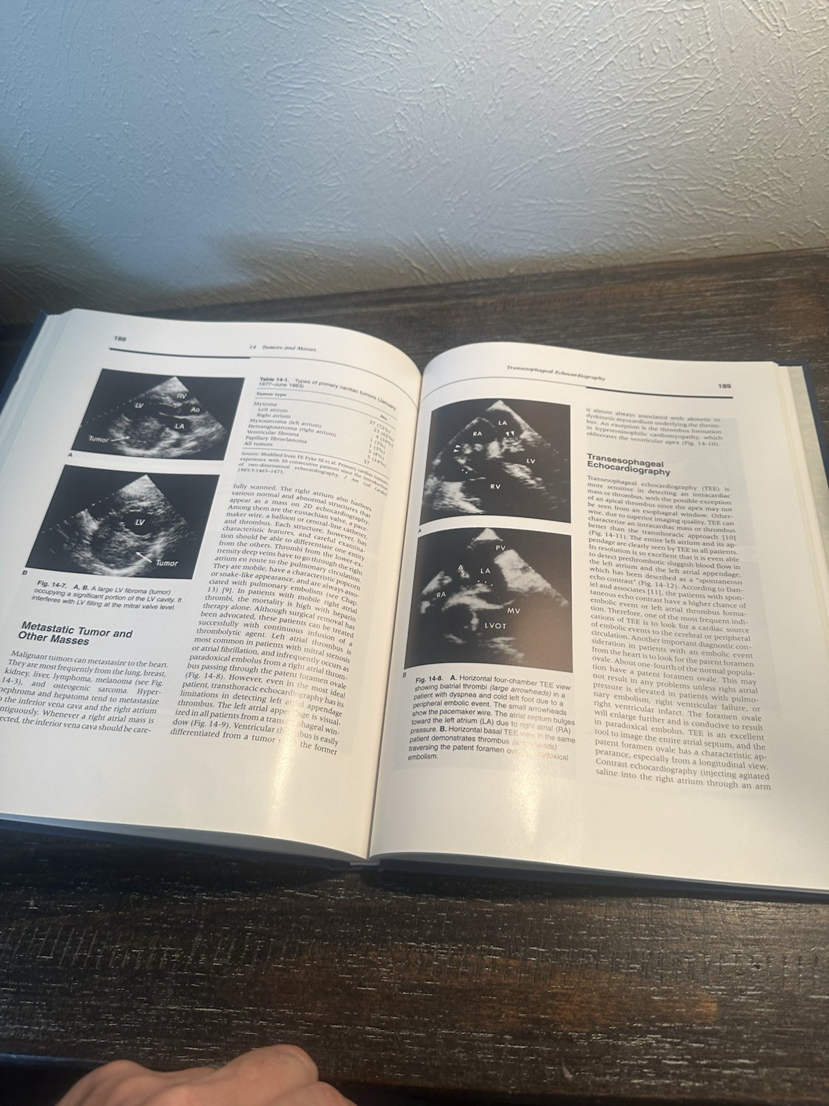 THE ECHO MANUAL: FROM THE MAYO CLINIC Jae K. Oh & James B. Seward – Hardcover