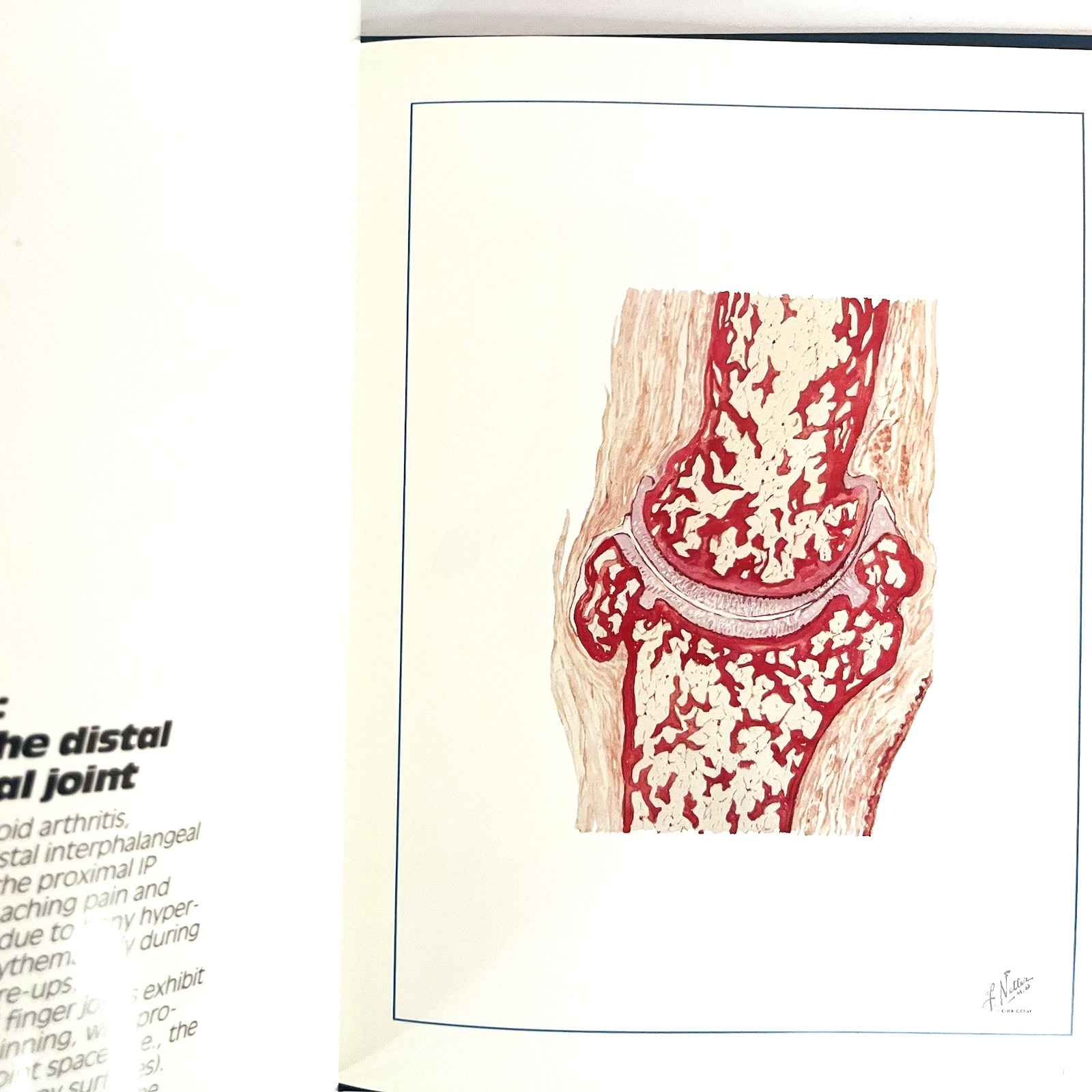 Voltaren Diclofenac Sodium Special Edition Book Hardcover Limited Edition 1987