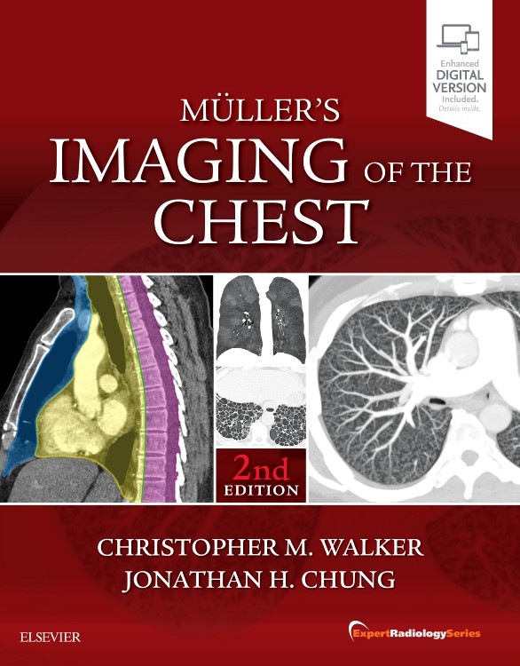 Muller&rsquo;s Imaging of the Chest