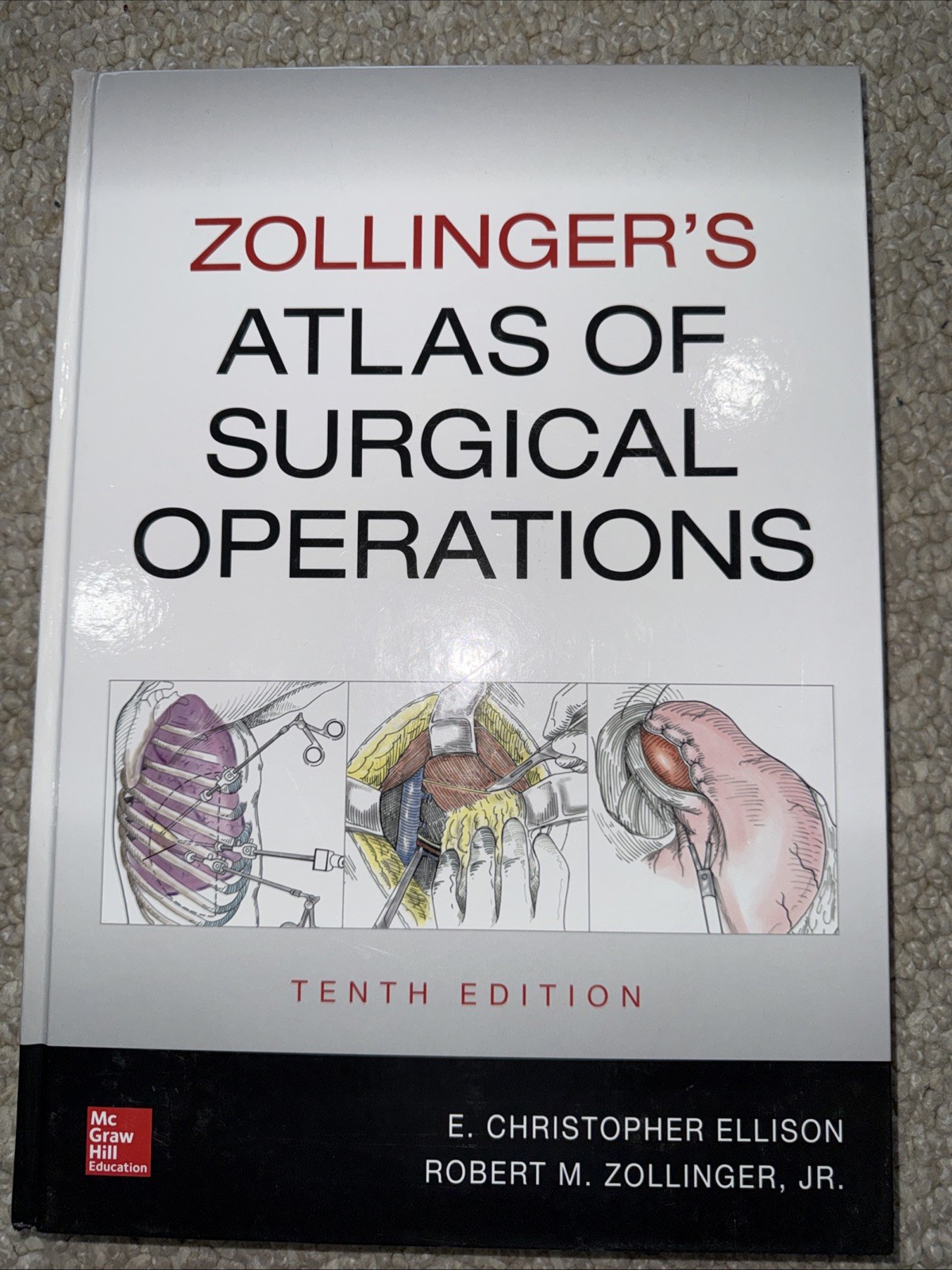 Zollinger&rsquo;s Atlas of – Hardcover, by Zollinger Robert; Ellison – Very Good