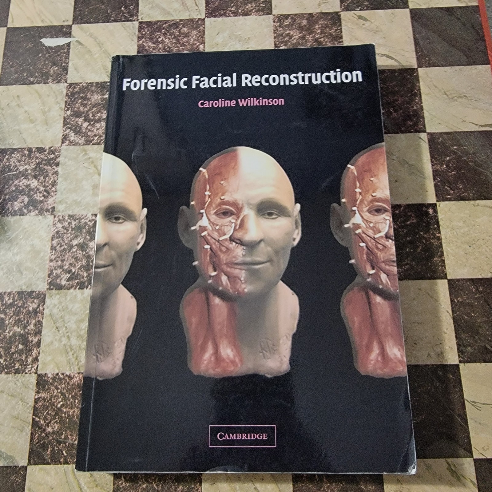 Forensic Facial Reconstruction by Caroline Wilkinson (2008, Trade Paperback)