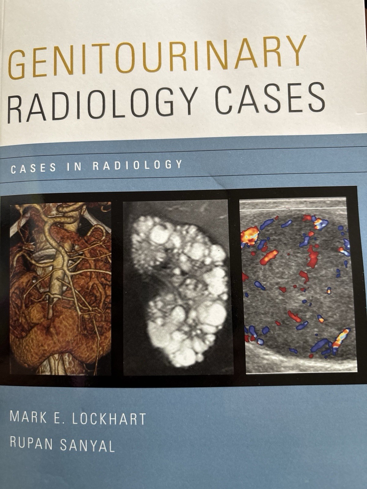Cases in Radiology Ser. Genitourinary Radiology Cases by Rupan Sanyal 2014