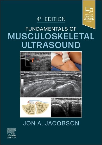 Fundamentals of Musculoskeletal Ultrasound, Paperback by Jacobson, Jon A., Li…