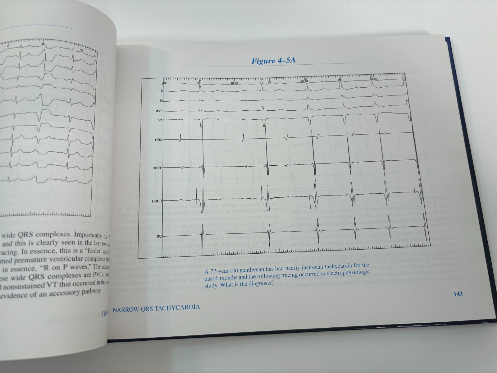 Clinical Electrophysiology Review 2nd Edition by George Klein — Hardcover 2013